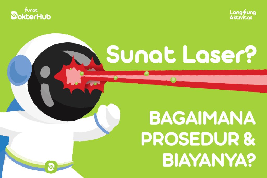 Sunar Laser adalah